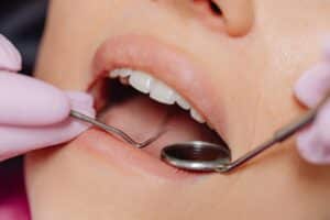 Why Your Breath Still Smells, Even After Brushing