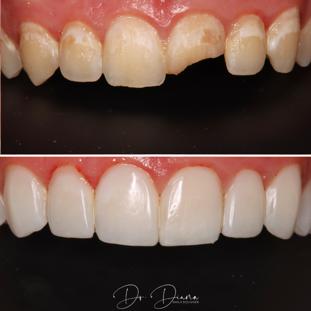 template for posts(2) (16)